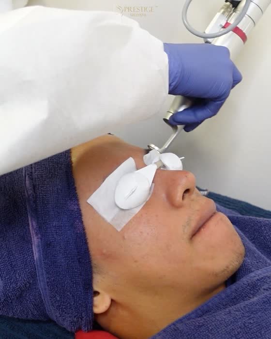 Azzfar Hassan di Prestige Medispa